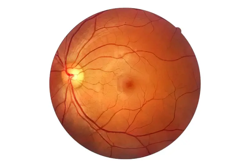 Структура сітківки ока, її будова і функції 6