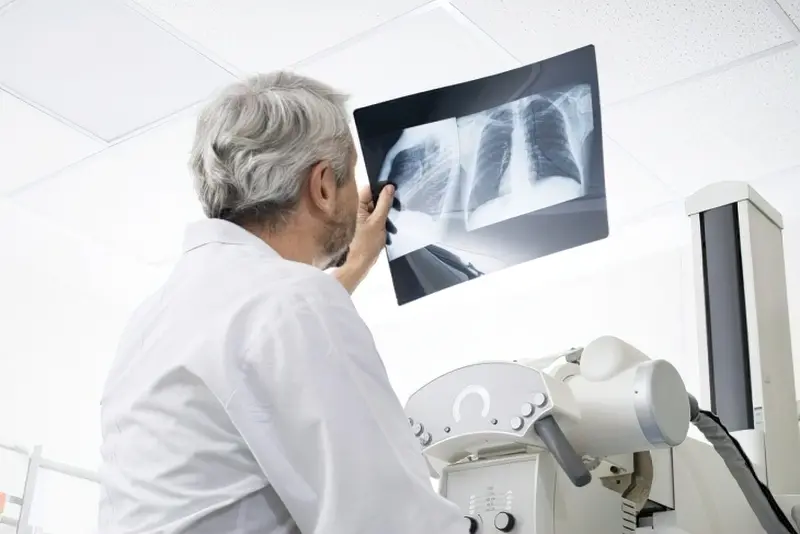 При надходженні в стаціонар хворому відразу ж проводять рентгенографію органів грудної клітини