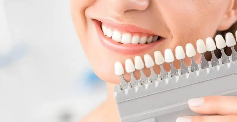 Чому жовтіють зуби та методи відбілення 13