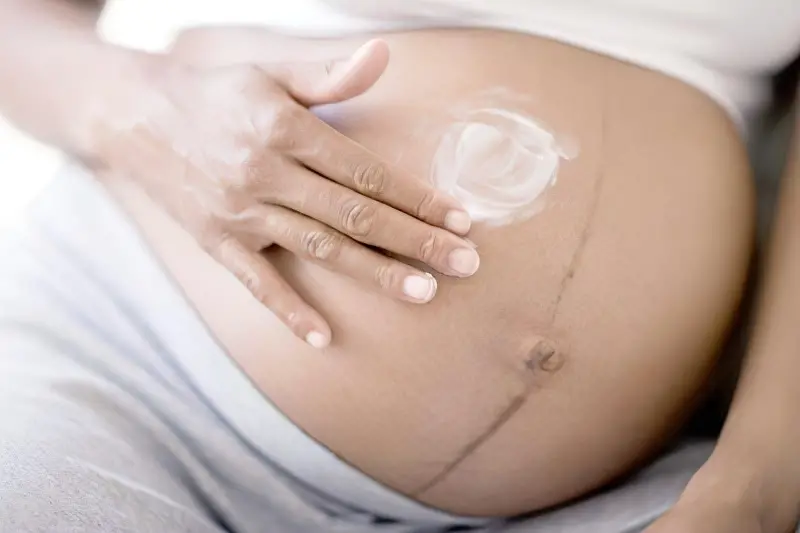 Смужка на животі при вагітності: звідки береться, коли проходить 2