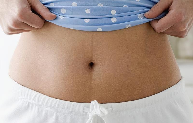 Смужка на животі при вагітності: звідки береться, коли проходить 6
