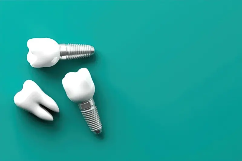 Протезування зубів: види, переваги та рекомендації 1